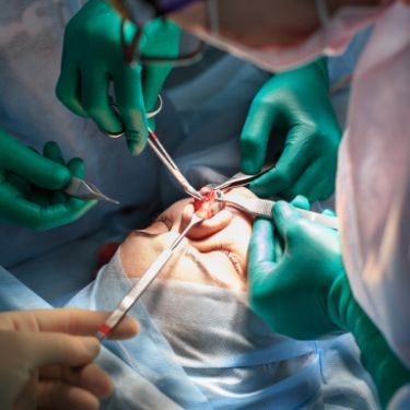 Rhinoplastie ouverte dans le bloc opératoire