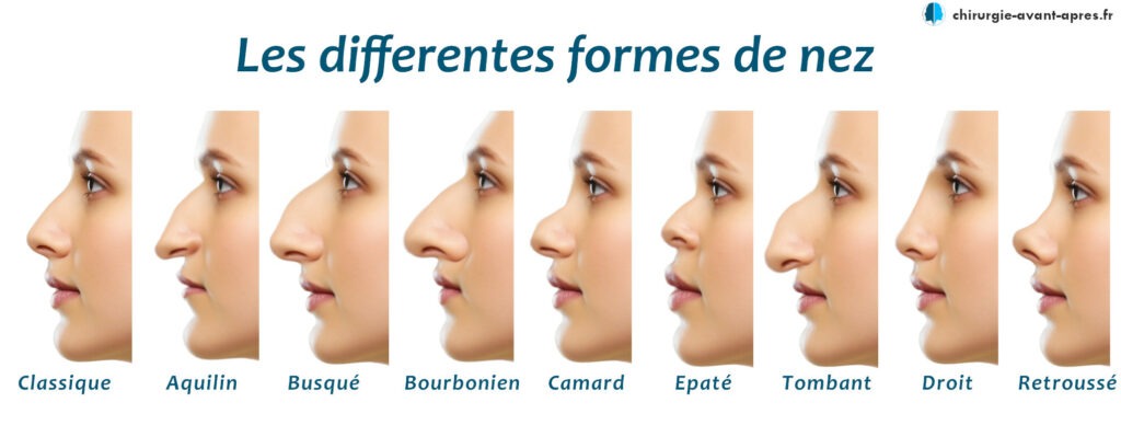 Formes de nez rhinoplastie