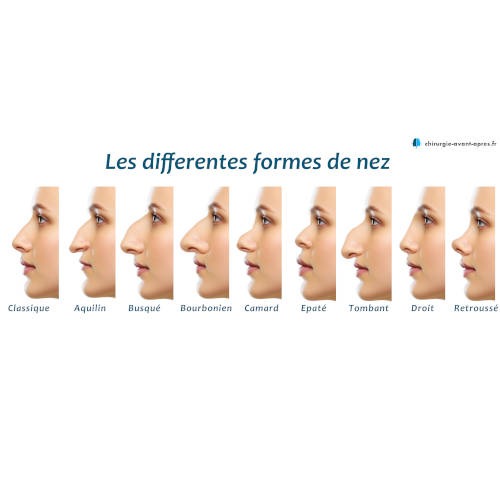 formes nez rhinoplastie