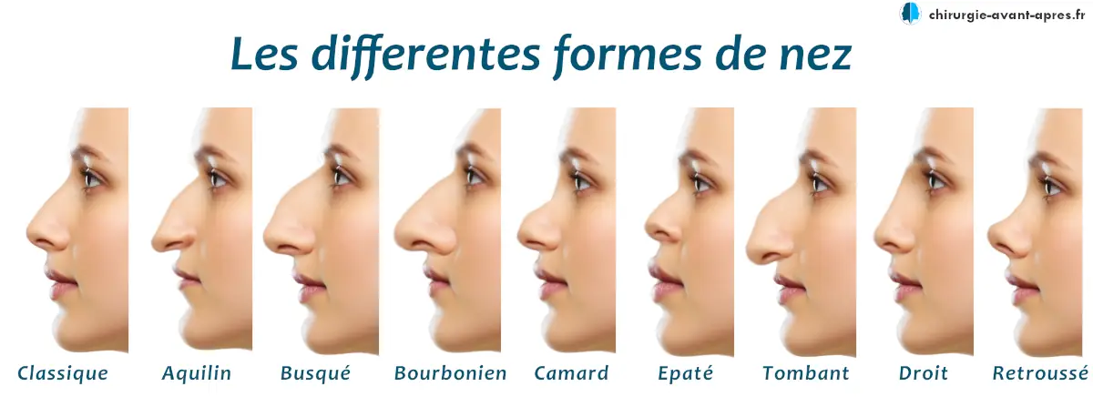 Les différentes formes de nez chirurgie