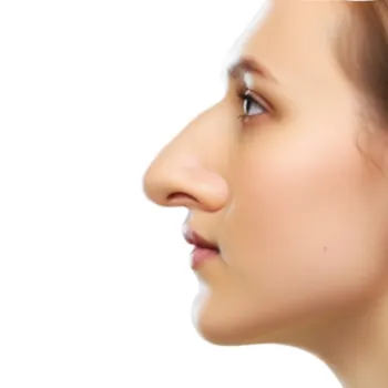 gros-nez-rhinoplastie