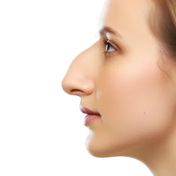 nez-bossu-rhinoplastie