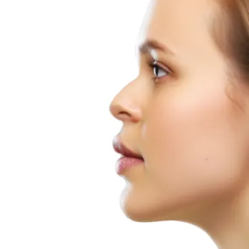 nez-écrasé-rhinoplastie