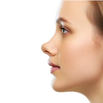 nez-en-trompette-rhinoplastie