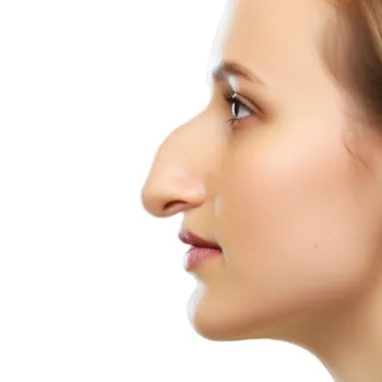 nez-qui-tombe-rhinoplastie