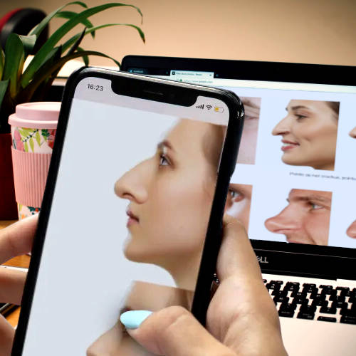 simulateur pc smartphone rhinoplastie